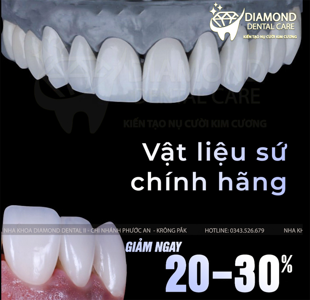 Làm răng sứ chất lượng Phước An Daimond II