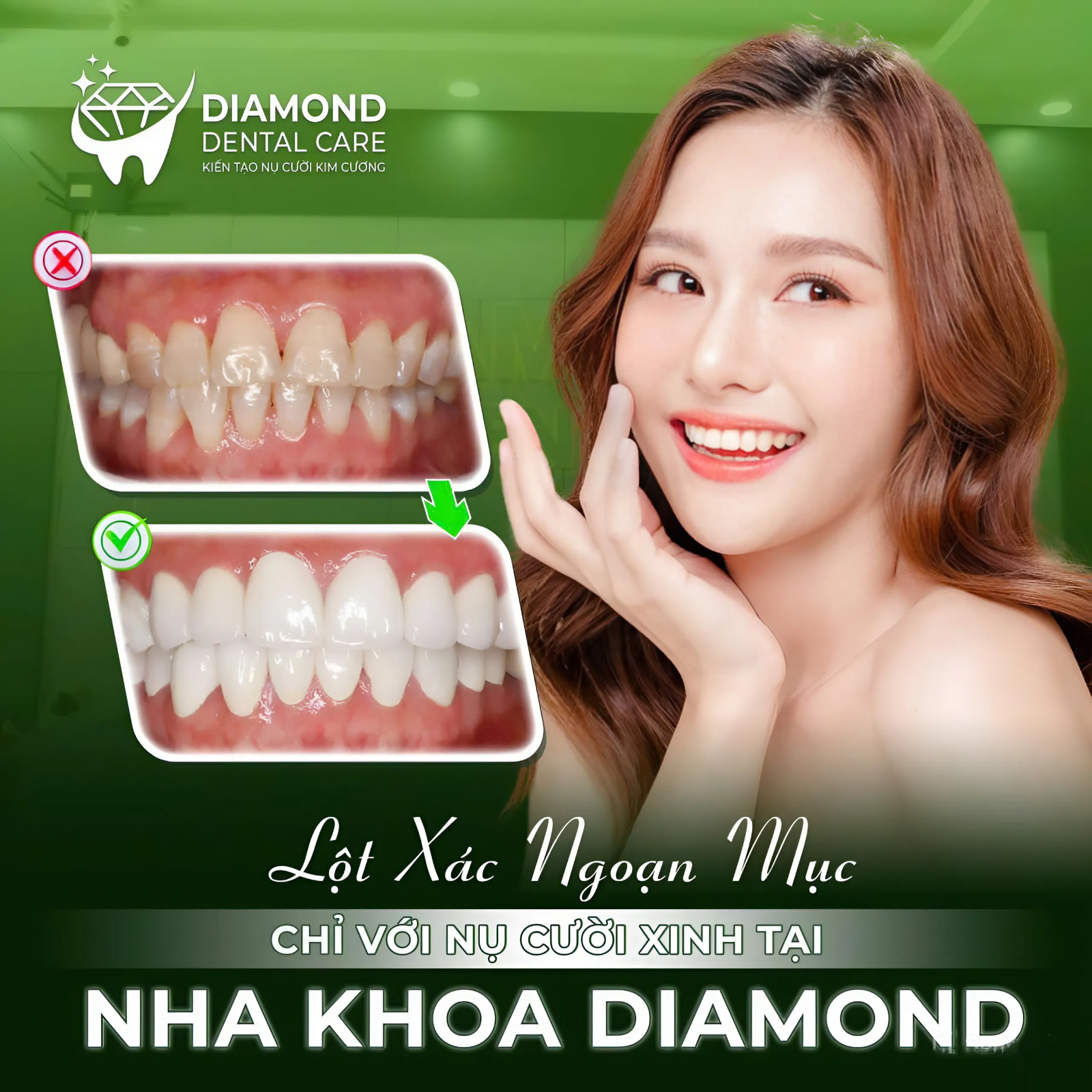 Nụ cười xinh tại Nha Khoa Daimond Phước An